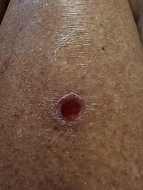 One is a close up versus distance shot