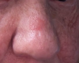 Picture of nose